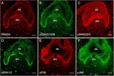 Operation of the Atypical Canonical Bone Morphogenetic Protein Signaling Pathway During Early Human Odontogenesis